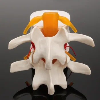 Modelo de ensino cérebro do crânio traumático pistola escola suprimentos médicos instrume anatomia Humana esqueleto Coluna Lombar, Hérnia de Disco